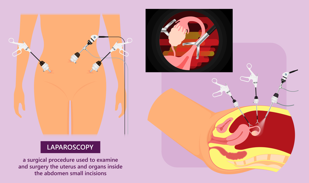 Consultant General & Laparoscopic Surgeon, Proctologist & Colorectal Surgeon in Pune