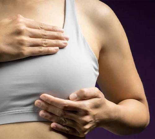 Understanding Breast Lumps